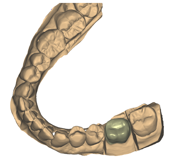 Servicios Lana Dental Design